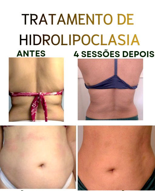 Antes e Depois Estética